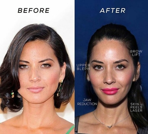 A picture of Olivia Munn before (left) and after (right).